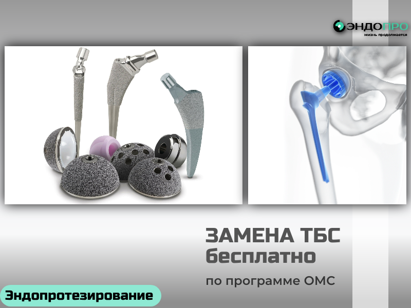 Эндопротезирование по ОМС: высокотехнологичная помощь без финансовых барьеров
Мечтаете снова двигаться без боли и ограничений? Сегодня эндопротезирование, выполненное в современных операционных российских клиник, доступно гражданам бесплатно — в рамках программы ОМС. При этом уровень медицинской помощи соответствует ведущим мировым стандартам: технологии, протоколы и квалификация специалистов позволяют добиваться стабильных и предсказуемых результатов.
В операционных, где проводят такие вмешательства, продумана каждая деталь, влияющая на безопасность и эффективность лечения. Стерильные условия, строгий контроль асептики, продуманная эргономика пространства — всё это снижает риски осложнений и создаёт оптимальные условия для работы хирургической бригады.
Ключевую роль играет современное оснащение: системы интраоперационной визуализации и навигации позволяют отслеживать ход вмешательства в реальном времени. А специализированные ортопедические инструменты и шаблоны помогают установить эндопротез с учётом индивидуальных анатомических особенностей пациента. Такой подход обеспечивает точную позиционировку компонентов, надёжную фиксацию и правильную биомеханику сустава — а значит, способствует более быстрому восстановлению и возвращению к активной жизни.