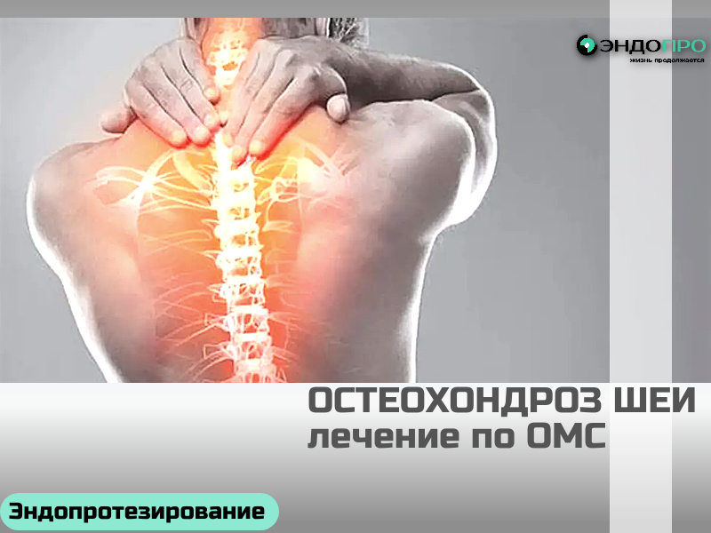 Шейный остеохондроз: лечение бесплатно по ОМС для граждан РФ
Шейный остеохондроз — дегенеративно‑дистрофическое поражение межпозвонковых дисков и окружающих структур шейного отдела. Лечение по ОМС доступно всем гражданам РФ при наличии медицинских показаний и проводится по стандартам оказания медицинской помощи.
Что входит в объём бесплатной помощи по ОМС:
Консультация врача (терапевта, невролога, травматолога‑ортопеда) — первичный и повторные приёмы.
Диагностика по назначению врача: рентген шейного отдела, МРТ или КТ (при показаниях), УЗИ сосудов шеи, иные исследования согласно клиническим рекомендациям.
Медикаментозная терапия в рамках стандартов: препараты для купирования боли и воспаления, снятия мышечного спазма, улучшения кровотока, витамины группы B и т. д. (обеспечение лекарствами зависит от условий льготного лекарственного обеспечения в регионе).
Физиотерапия: электрофорез, магнитотерапия, лазеротерапия, ультразвук и другие методы из утверждённых перечней.
ЛФК и лечебная гимнастика под контролем специалиста, включая обучение домашнему комплексу.
Как получить помощь по ОМС:
Записаться к терапевту в поликлинике по месту прикрепления — он проведёт первичный осмотр и при необходимости направит к узким специалистам.
Пройти обследования, назначенные врачом (рентген, МРТ, анализы и т. п.) — они нужны для постановки диагноза и выбора тактики.
Получить консультации профильных врачей (невролог, ортопед) — часто требуется для уточнения показаний к конкретным методам лечения.
Следовать назначенному плану: курсы физиотерапии, ЛФК, медикаментозной терапии оформляются через поликлинику или дневной стационар.
При необходимости — врач инициирует направление на ВМП (если случай относится к высокотехнологичной помощи).
Сроки ожидания отдельных исследований (например, МРТ) зависят от региона и загруженности медучреждений. При остром болевом синдроме помощь оказывают в приоритетном порядке.