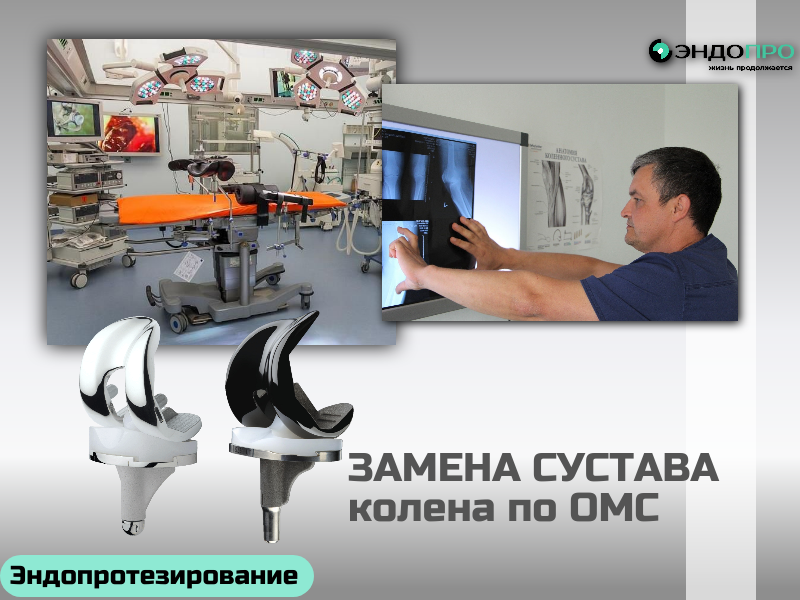 Граждане России могут пройти операцию по замене коленного сустава полностью бесплатно — за счёт средств ОМС.
Вмешательство входит в программу государственных гарантий и финансируется из бюджета системы обязательного медицинского страхования.
Что покрывает полис ОМС:
консультацию травматолога‑ортопеда и определение показаний к операции;
все необходимые обследования (рентген, МРТ, анализы и т. д.) по назначению врача;
сам эндопротез (в рамках утверждённых перечней медицинских изделий);
проведение операции, включая анестезию;
пребывание в стационаре, питание и медикаменты;
наблюдение в раннем послеоперационном периоде и базовые рекомендации по реабилитации.
Пошаговый алгоритм получения помощи:
Обратиться в поликлинику к терапевту или сразу к травматологу‑ортопеду по месту прикрепления.
Пройти обследования, которые назначит врач, чтобы подтвердить показания к эндопротезированию.
Получить направление по форме 057/у‑04 — его оформляет лечащий врач при наличии медицинских показаний.
Собрать документы: паспорт, полис ОМС, СНИЛС, результаты исследований, выписку из амбулаторной карты.
Передать документы в профильную клинику — это может сделать поликлиника (через электронный документооборот) либо сам пациент.
Дождаться решения врачебной комиссии и даты госпитализации.
Срок ожидания плановой операции зависит от региона и загруженности клиники и может составлять от нескольких недель до нескольких месяцев. При экстренных и срочных показаниях (например, при тяжёлой травме или выраженном нарушении функции сустава) пациента оперируют вне общей очереди