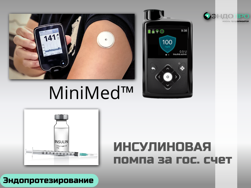 Инсулиновая помпа Medtronic MiniMed 720G — бесплатно по ОМС для граждан России от 18 лет

Пациенты с сахарным диабетом могут получить инсулиновую помпу Medtronic MiniMed 720G бесплатно в рамках программы ОМС при наличии медицинских показаний и соблюдении установленных критериев.
Что входит в программу:
предоставление самой помпы Medtronic MiniMed 720G;
госпитализация для установки и первичной настройки устройства;
обучение пациента основам помповой инсулинотерапии (практические навыки, работа с интерфейсом, действия при тревожных сигналах);
подбор индивидуальных параметров терапии под контролем эндокринолога;
базовый комплект расходных материалов на начальный период (по перечню медорганизации).
Основные условия получения:
гражданство РФ и действующий полис ОМС;
возраст — от 18 лет;
подтверждённый диагноз, требующий помповой терапии (решение принимает врачебная комиссия на основании клинических рекомендаций);
наличие направления по форме 057/у‑04 от лечащего врача.
Пошаговый алгоритм:
Консультация эндокринолога в поликлинике по месту прикрепления — для оценки показаний и противопоказаний.
Прохождение обследований по утверждённому протоколу (лабораторные анализы, данные самоконтроля гликемии, выписки из предыдущих госпитализаций и т. п.).
Получение направления 057/у‑04 на госпитализацию для установки помпы.
Сбор документов: паспорт, полис ОМС, СНИЛС, результаты обследований, выписка из амбулаторной карты.
Передача документов в профильную клинику (через поликлинику или самостоятельно) и получение вызова на госпитализацию.
Госпитализация, установка помпы, обучение и выписка с планом дальнейшего наблюдения у эндокринолога по месту жительства.
Срок ожидания зависит от региона и загруженности отделения. Все этапы, включая обучение и первичную настройку, полностью покрываются ОМС

Дистанционную консультацию можно пройти (Бесплатно), не приезжая в Центр, список заключений необходимо прислать по электронной почте для рассмотрения нашей врачебной комиссией