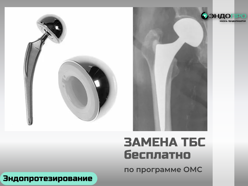 Эндопротезирование тазобедренного сустава в России: возможности, подходы и особенности оказания помощи
Эндопротезирование тазобедренного сустава — одна из наиболее востребованных операций в российской ортопедии. Она позволяет вернуть пациенту подвижность, избавить от хронической боли и существенно повысить качество жизни. В России эта помощь доступна по разным каналам — от высокотехнологичной медицинской помощи (ВМП) по квотам до платных услуг в частных клиниках.
Когда показана операция
Чаще всего эндопротезирование рекомендуют при выраженных дегенеративных изменениях сустава: тяжёлом коксартрозе, асептическом некрозе головки бедренной кости, последствиях переломов шейки бедра, а также при ряде ревматологических состояний. Решение о необходимости операции принимает врач‑травматолог‑ортопед на основании жалоб, осмотра и данных лучевой диагностики (рентген, при необходимости — КТ или МРТ).
Какие варианты эндопротезирования применяют
В российских клиниках используют разные подходы, подбирая оптимальный для конкретного пациента:
Тотальное эндопротезирование. Заменяют и вертлужную впадину, и головку бедренной кости — это самый распространённый вариант при выраженном разрушении сустава.
Гемиартропластика (частичное протезирование). Меняют только головку бедренной кости; чаще применяют при переломах шейки бедра у пожилых пациентов.
Ревизионное эндопротезирование. Проводят при необходимости замены ранее установленного протеза из‑за износа, нестабильности или осложнений.
