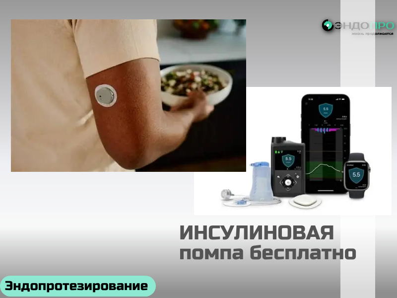 Суточное мониторирование уровня глюкозы: ключ к персонализированной терапии по ОМС для граждан России от 18 лет
Стандартные замеры глюкозы с помощью портативного глюкометра дают лишь точечные данные — они фиксируют концентрацию сахара в конкретный момент, но не отражают динамику его колебаний в течение суток. Из‑за такого ограниченного набора сведений бывает сложно выявить закономерности: например, понять, какие факторы (приём пищи, физическая нагрузка, стресс, время суток) провоцируют подъёмы или резкие падения сахара. А без полной картины трудно выстроить лечение, которое действительно учитывает индивидуальные особенности организма пациента.

Система непрерывного мониторирования глюкозы решает эту проблему: она автоматически фиксирует показатели с заданной периодичностью и формирует развёрнутый профиль гликемии. В результате врач получает детализированную картину — видит не только средние значения, но и эпизоды гипо‑ и гипергликемии, их продолжительность и связь с повседневными событиями.