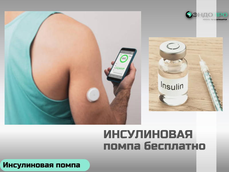 Сколько времени занимает установка инсулиновой помпы? БЕСПЛАТНО (ОТ 18 ЛЕТ)
Сама установка инсулиновой помпы занимает примерно 30–60 минут. Но весь визит в клинику обычно длится дольше — около 2 часов, потому что врач ещё подробно объясняет, как пользоваться устройством, настраивает базовые параметры с учётом ваших показателей и отвечает на вопросы. 