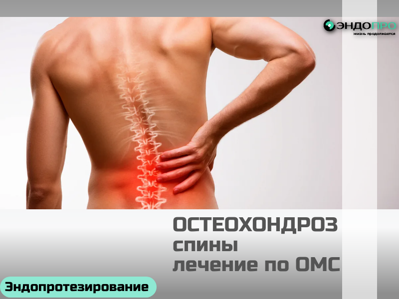 Остеохондроз спины лечение по программе ОМС для граждан РФ Лечить остеохондроз спины по ОМС можно, и спектр доступной помощи довольно широкий. В поликлинике по прикреплению вам проведут осмотр, назначат необходимые исследования (рентген, по показаниям — МРТ или КТ) и составят план лечения. В базовый объём входят консультации невролога, медикаментозная терапия (обезболивающие, миорелаксанты, витамины), физиотерапия (электрофорез, магнитотерапия, лазер и др.), массаж, лечебная физкультура и, при необходимости, блокады. Если консервативные методы не дают результата или процесс прогрессирует, по направлению лечащего врача возможна госпитализация в профильное неврологическое или нейрохирургическое отделение, где проводят более интенсивное лечение, включая капельницы, вытяжение и паравертебральные инъекции. Чтобы получить помощь, достаточно записаться к терапевту или сразу к неврологу (если есть направление) в своей поликлинике. Врач определит объём исследований и при наличии показаний оформит направление как на амбулаторное лечение, так и на стационарное — в рамках ОМС это полностью бесплатно. Важно учитывать: некоторые процедуры (например, отдельные виды массажа или курс ЛФК) могут иметь ограничения по кратности и доступны только при подтверждённом диагнозе и отсутствии противопоказаний.