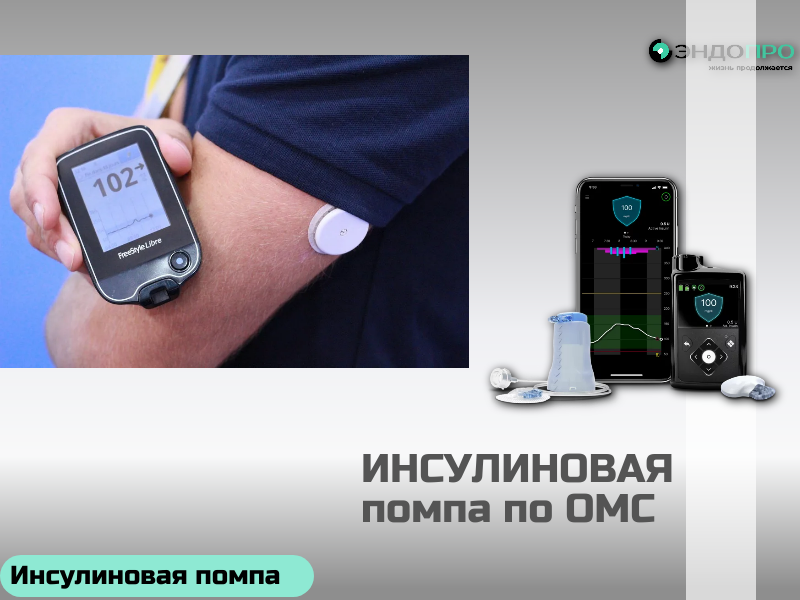 Особенности инсулиновой помпы Medtronic MiniMed 720G (по ОМС Бесплатно от 18 лет) MiniMed 720G — это система непрерывной инсулинотерапии с функцией автоматической приостановки подачи при риске гипогликемии. Помпа работает только с ультракороткими аналогами инсулина и подаёт его через инфузионный набор, который меняют раз в три дня, избавляя от многократных уколов. Точность дозирования. Минимальный шаг подачи — 0,025 Ед, что особенно ценно для детей и пациентов с высокой чувствительностью к инсулину. Базальный профиль настраивается на 48 временных интервалов в сутки, всего можно сохранить до 8 разных профилей. Временная базальная скорость задаётся в диапазоне 0–200% от исходной на срок от 30 минут до 24 часов. Технология SmartGuard. В связке с сенсором Guardian Sensor 3 и трансмиттером Guardian Link 3 помпа отслеживает уровень глюкозы в реальном времени и прогнозирует его тренд. Если система предвидит падение сахара, она автоматически приостанавливает подачу инсулина — это снижает риск ночных и дневных гипогликемий. Практичность. Питание от стандартной батарейки AA, память на 90 дней работы, синхронизация с приложением MiniMed Mobile и платформой CareLink для удалённого доступа врача и близких. Гарантия производителя — 4 года.