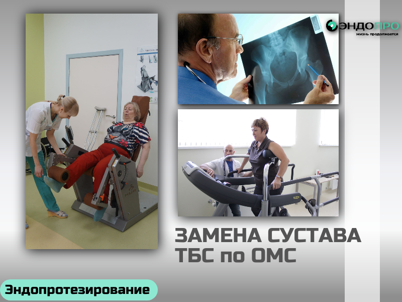 Замена тазобедренного сустава по ОМС — бесплатная операция при наличии показаний Государство покрывает вмешательство, протез, стационар, медикаменты и питание. Для оформления нужно обратиться к ортопеду/травматологу — врач проведёт осмотр, назначит обследования и при необходимости выдаст направление. Решение принимает врачебная комиссия на основании снимков, анализов и состояния пациента. Срок ожидания — от нескольких недель до года (зависит от региона и загруженности клиники); в экстренных случаях (например, при переломе шейки бедра) операцию делают вне очереди. После вмешательства пациенту предоставляют реабилитацию: ЛФК, физиотерапию и