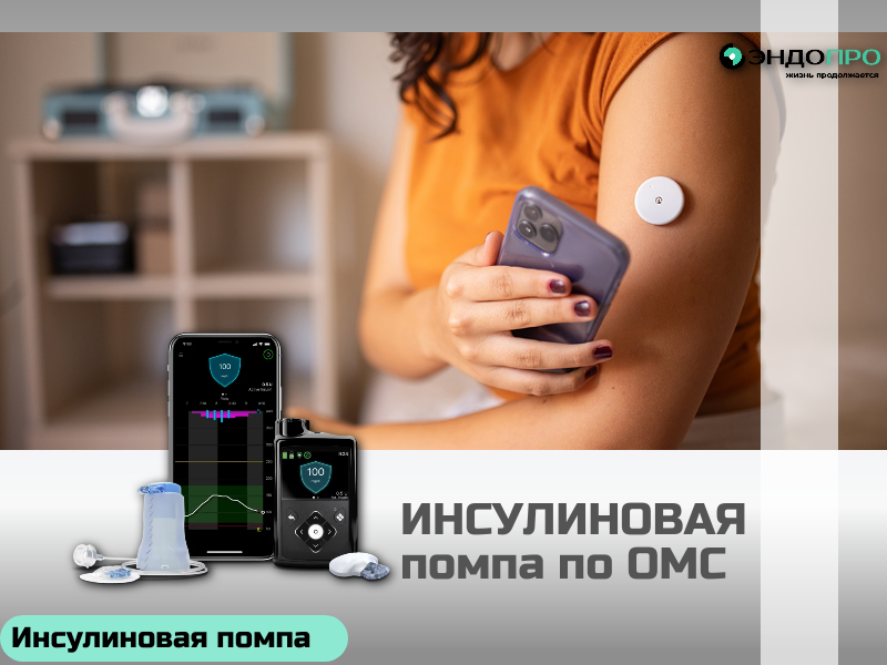 Как инсулиновая помпа поддерживает контроль глюкозы ночью? БЕСПЛАТНО (ОТ 18 ЛЕТ) Во время сна инсулиновая помпа обеспечивает стабильный уровень сахара за счёт непрерывной подачи инсулина в базальном режиме — это имитирует естественную работу поджелудочной железы и покрывает базовые потребности организма в отсутствие еды. Гибкая настройка под ночные ритмы Профиль базальной подачи можно адаптировать по часам, учитывая индивидуальные особенности углеводного обмена: Снижение скорости вскоре после ужина. В этот период риск гипогликемии нередко выше, и уменьшенная доза помогает избежать падения сахара. Увеличение к утренним часам. Это компенсирует «феномен зари» — естественный рост глюкозы из‑за выброса контринсулярных гормонов перед пробуждением. Контроль и автоматическая коррекция Точность настройки проверяют, сопоставляя профиль с ночными измерениями глюкометра. В продвинутых системах с непрерывным