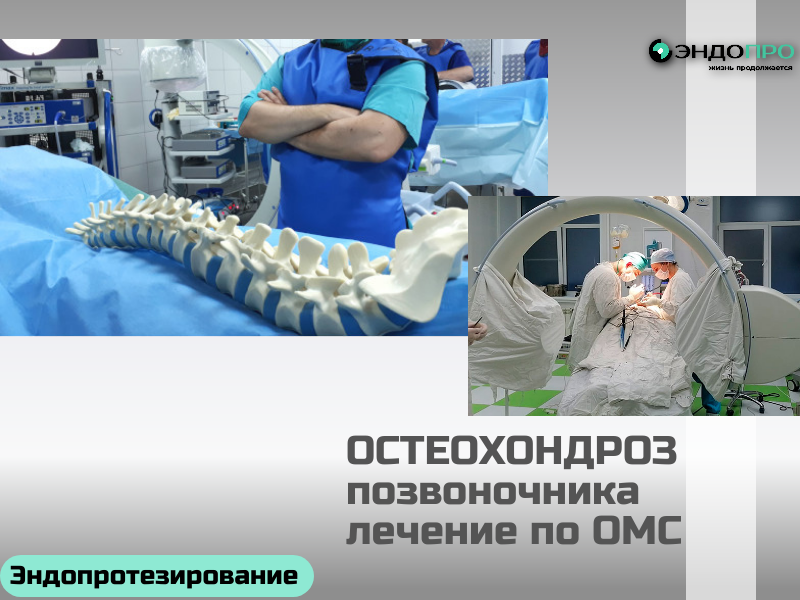 Лечение остеохондроза по ОМС: что доступно гражданам РФ? При остеохондрозе по полису ОМС можно получить комплексную помощь — главное, чтобы врач подтвердил показания. Обычно подход мультидисциплинарный: подбирают комбинацию методов. Что может войти в программу: Консультация специалиста. Сначала нужно попасть к врачу (ортопеду, неврологу или вертебрологу). Направление выдаёт терапевт. Диагностика. При необходимости бесплатно назначат рентген, МРТ или УЗИ — если это нужно для точной картины. Медикаментозная терапия. Врач может выписать НПВП (для снятия боли и воспаления), миорелаксанты (при мышечных спазмах), хондропротекторы, сосудистые препараты или витамины группы B.