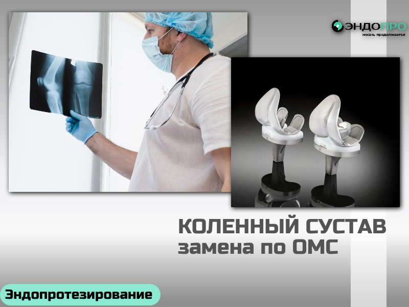 Дистанционная консультация перед эндопротезированием: грамотный старт пути к восстановлению подвижности По ОМС для граждан РФ Что входит в дистанционную консультацию На онлайн‑приёме врач‑ортопед или хирург-эндопротезист анализирует предоставленные материалы и даёт структурированные рекомендации. В типичном сценарии это: Оценка показаний и противопоказаний. Специалист изучает снимки (рентген, КТ, МРТ) и сопоставляет их с жалобами и анамнезом, чтобы определить, действительно ли эндопротезирование — оптимальный вариант в данном случае. Анализ качества и полноты обследований. Если данных недостаточно, врач формирует чёткий список дополнительных исследований: например, уточняет, какой проекции рентгена не хватает или какие лабораторные анализы важно сдать перед госпитализацией. Предварительный выбор тактики. На основании анатомии сустава и сопутствующих состояний врач может обозначить возможные варианты протеза и хирургического доступа, а также рассказать о нюансах, значимых именно для этого пациента (возраст, вес, уровень активности, сопутствующие заболевания). Прогноз и план